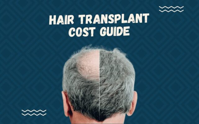 Hair Transplant Cost | Worth the Cost or Not?