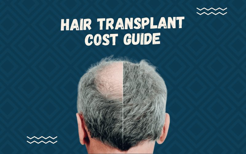 Image titled Hair Transplant Cost featuring a guy with a side-by-side before and after image