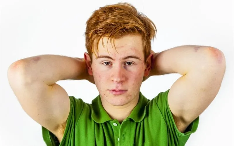 Sad looking man in a green shirt holds his head