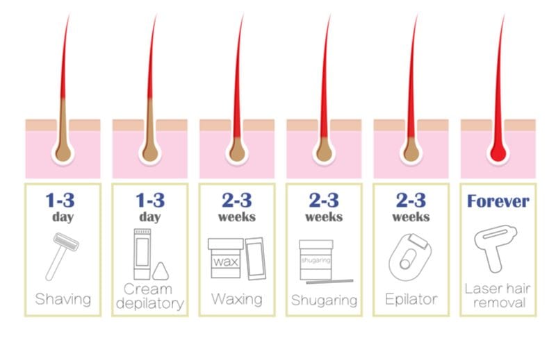 Laser Hair Removal Cost High, Low, & Average Prices