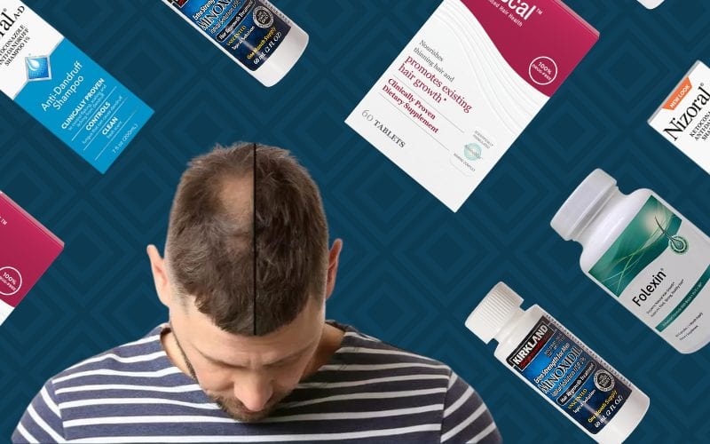 A number of hair loss products that work floating around the before and after of a man using the supplements