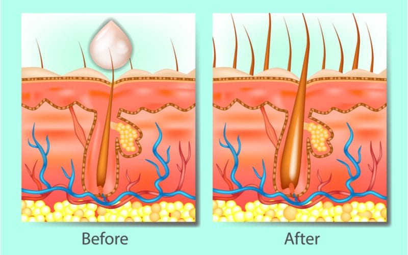 Hair growth shampoo pros and cons featuring a before and after to use the product in a cutaway image of the scalp and hair follicles