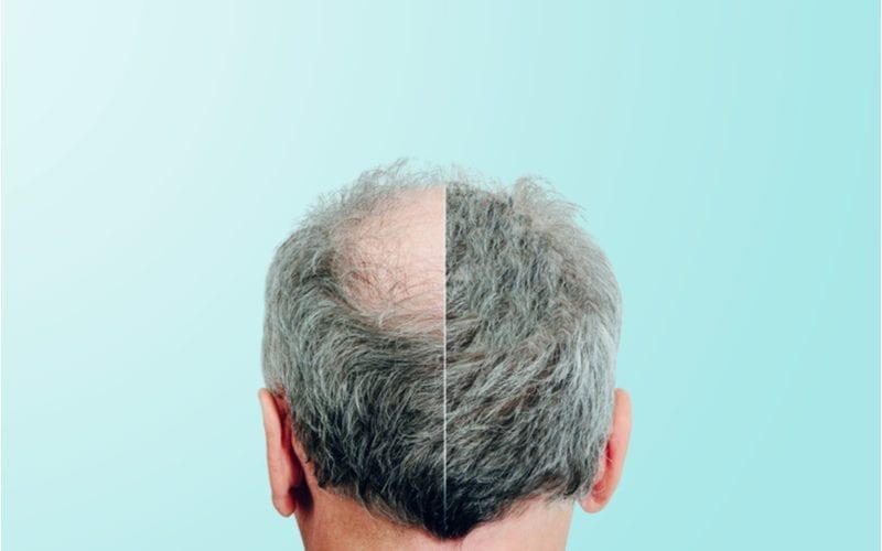 Image of a man standing in front of a blue wall with his half and half head for a piece on hair loss shampoo