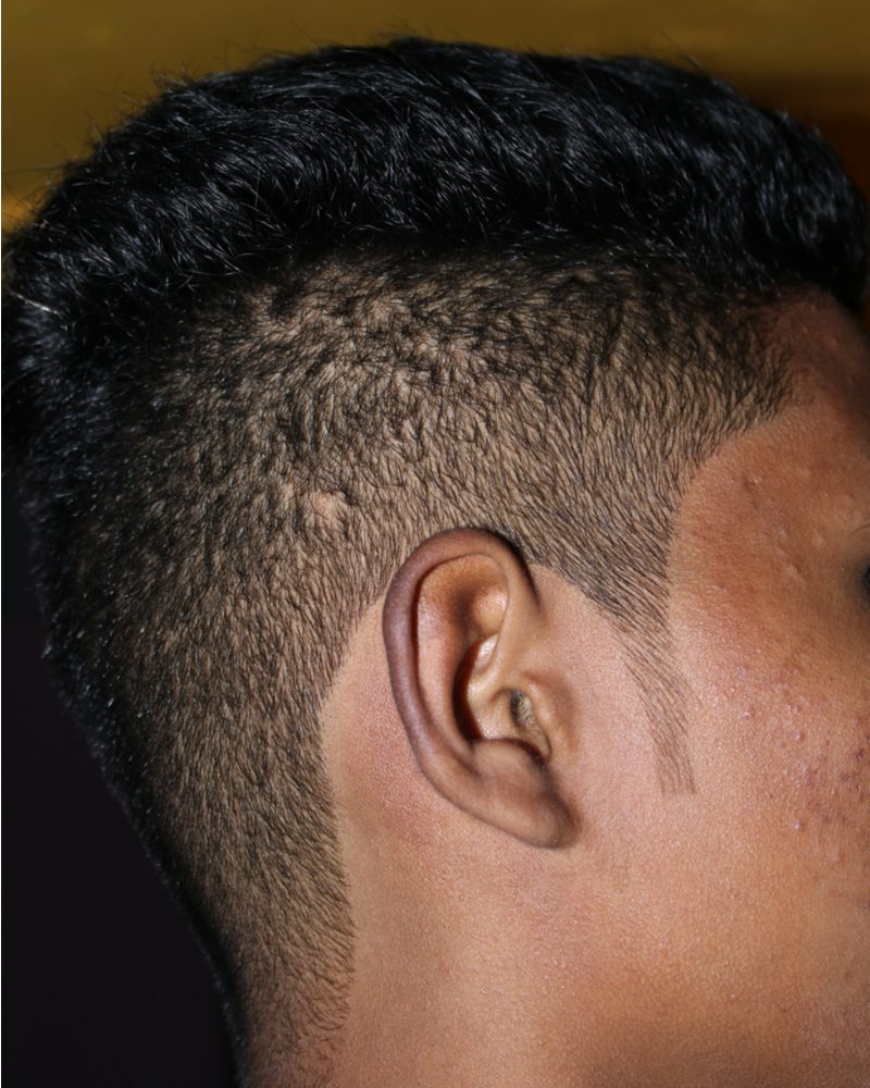Man getting a flat top buzzcut looks ahead in a side profile image