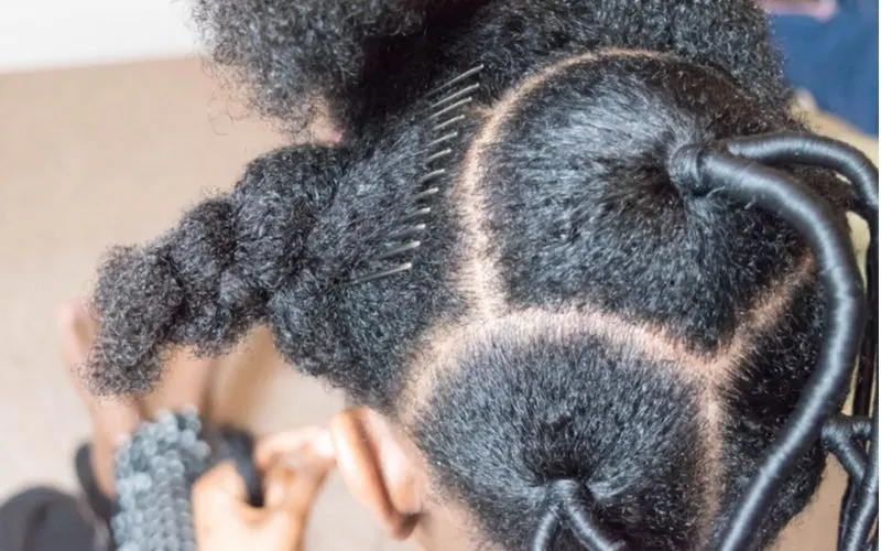 Woman who has scalp sores from braids as depicted with a close up image