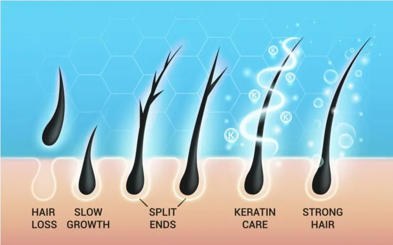 Scalp problems that could be causing dreadlocks to thin at the root