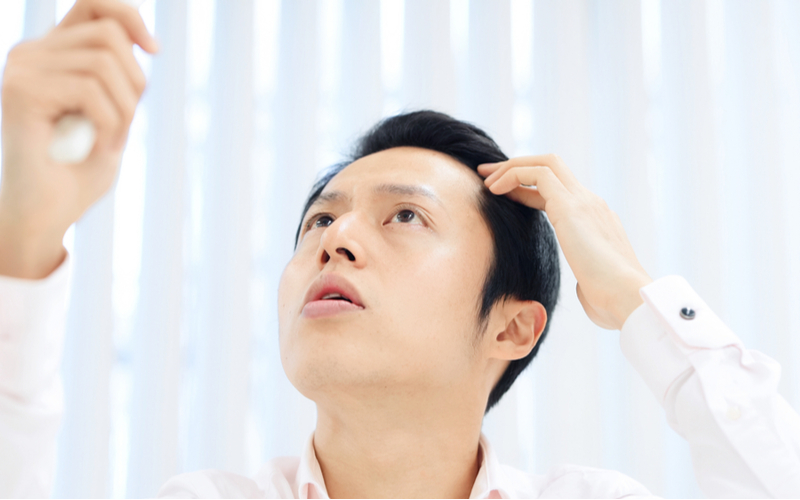 Để tìm hiểu về dầu gội ngăn chặn dht là gì, một chàng trai châu Á nhận thấy tình trạng rụng tóc của mình