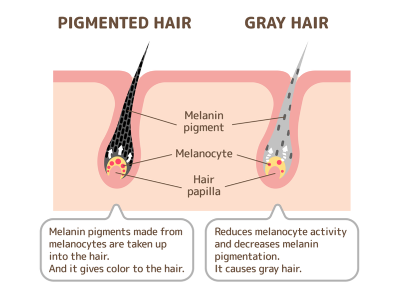 Graphic showing the aging process on hair to answer, "why won't my grey hair dye"
