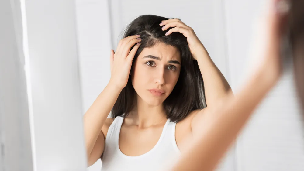 Woman with dandruff on her scalp pictured looking in a mirror in a white shirt
