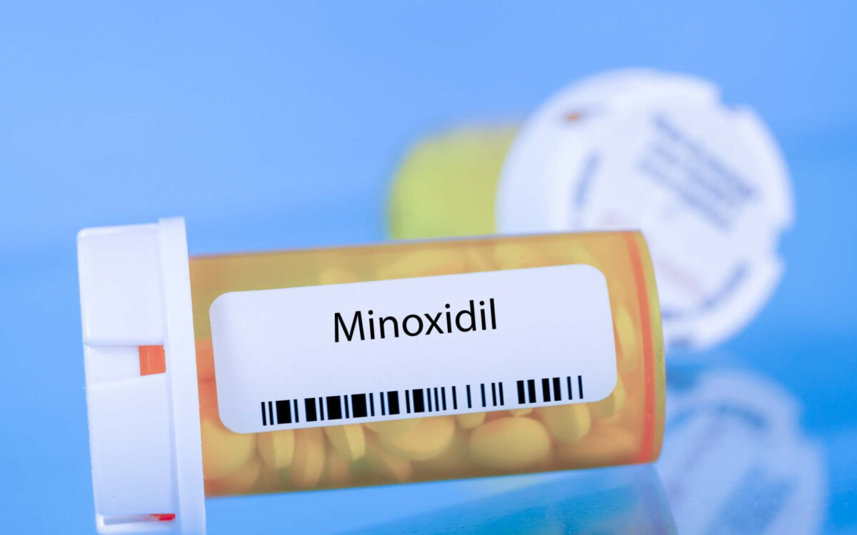The 7 Best Alternatives to Minoxidil to Know About in 2023