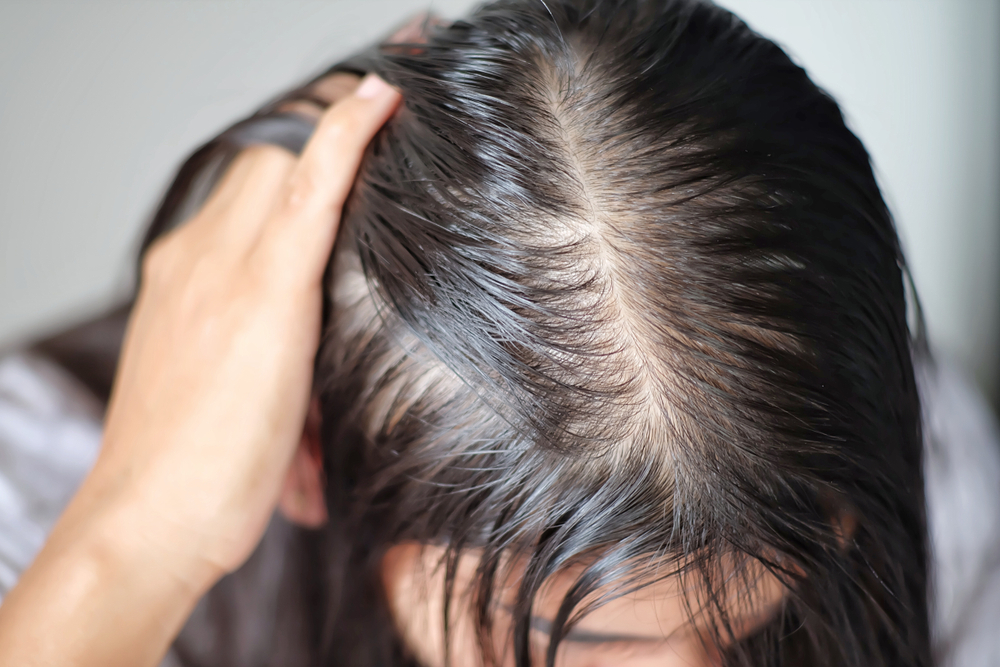 Woman with very oily hair pictured holding her hair back