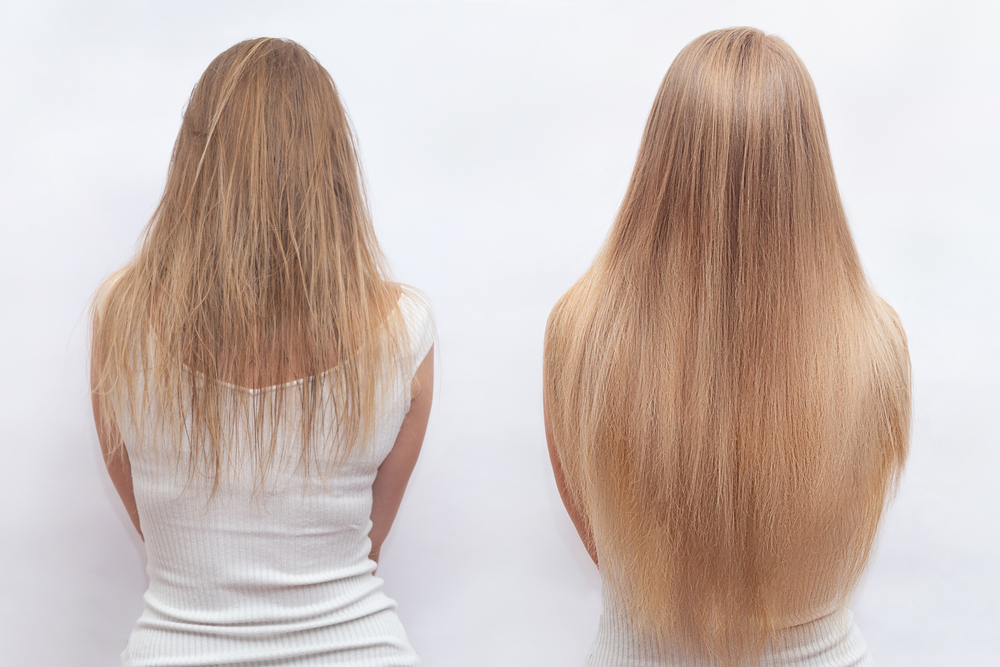 Người phụ nữ đang mọc tóc và thể hiện một số dấu hiệu tốt nhất của sự phát triển của tóc trong hình ảnh cạnh nhau