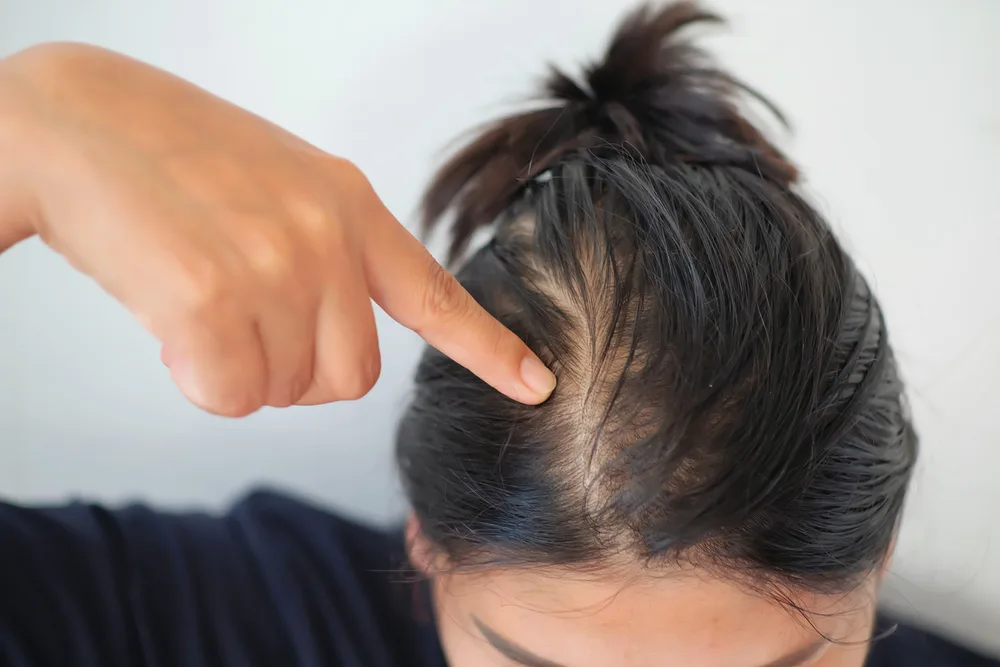 Woman with oily hair wondering when she should not condition her scalp