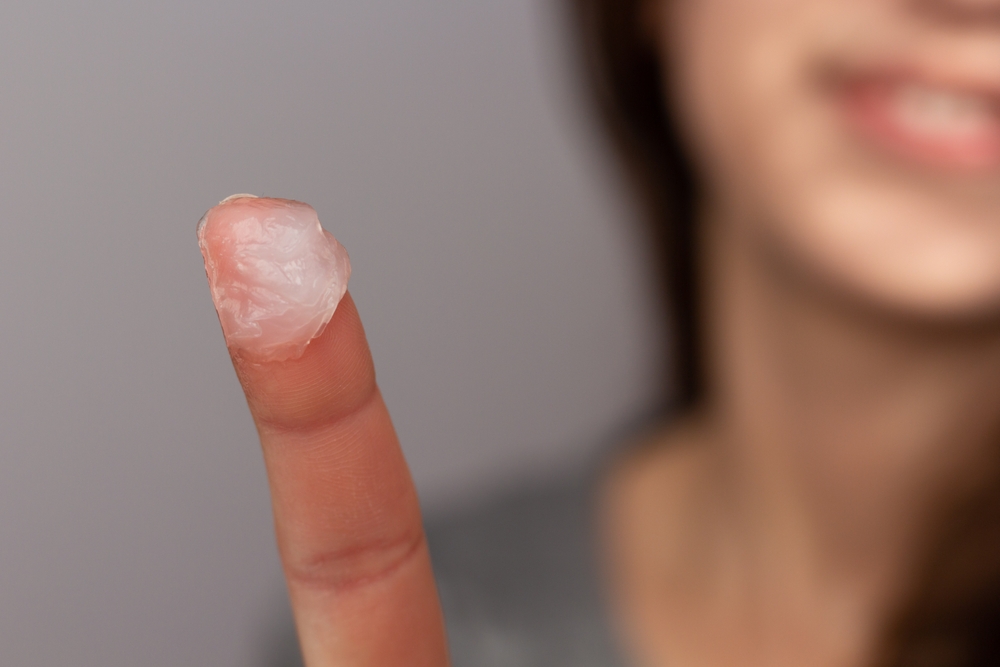 Woman holding up a finger with petroleum jelly on it and wondering what does Vaseline do to hair