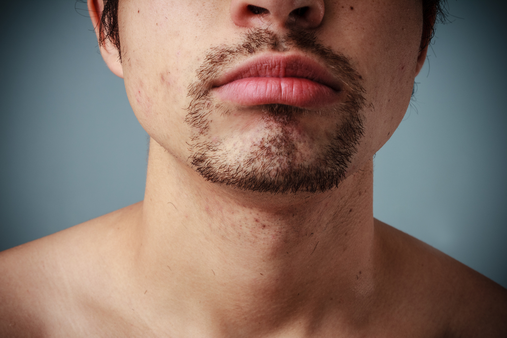 Close-up of the bottom half of a man's face featuring one of the basic goatee styles with a circle beard